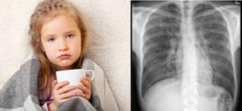 ZATÜRREE SİZDEN KORKSUN!