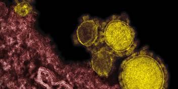 DÜNYA SAĞLIK ÖRGÜTÜ UYARIYOR: MERS VİRÜS ENFEKSİYONLARINA DİKKAT!